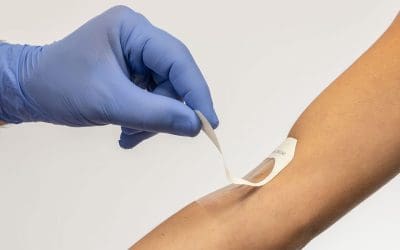 The Critical Factors To Consider When Selecting a Suitable Adhesive for Wearable Medical Devices