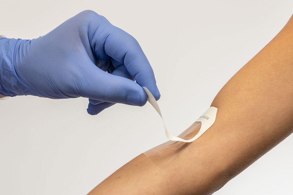 The Critical Factors To Consider When Selecting a Suitable Adhesive for Wearable Medical Devices